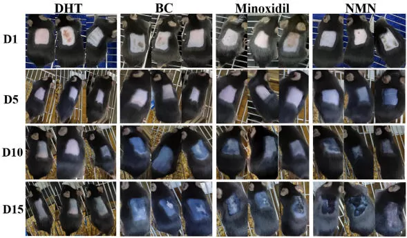 NMN and Hair Growth: New Evidence in Androgenetic Alopecia (AGA)